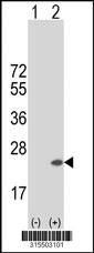 Western blot analysis of his-tag MED22 (arrow) using his tag antibody. 293 cell lysates (2 ug/lane) either nontransfected (Lane 2) or transiently transfected with theMED22 gene