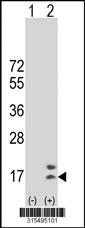 Western blot analysis of his-tag CDC26 (arrow) using his tag antibody. 293 cell lysates (2 ug/lane) either nontransfected (Lane 2) or transiently transfected with theCDC26 gene