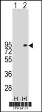 Western blot analysis of his-tag ARHGAP20 (arrow) using his tag antibody. 293 cell lysates (2 ug/lane) either nontransfected (Lane 2) or transiently transfected with theARHGAP20 gene