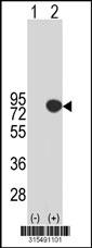 Western blot analysis of his-tag LCA5 (arrow) using his tag antibody. 293 cell lysates (2 ug/lane) either nontransfected (Lane 2) or transiently transfected with theLCA5 gene