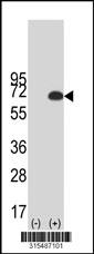 Western blot analysis of his-tag FAM134C (arrow) using his tag antibody. 293 cell lysates (2 ug/lane) either nontransfected (Lane 2) or transiently transfected with theFAM134C gene