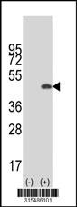 Western blot analysis of his-tag ZNF785 (arrow) using his tag antibody. 293 cell lysates (2 ug/lane) either nontransfected (Lane 2) or transiently transfected with theZNF785 gene