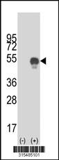 Western blot analysis of his-tag CREB3L4 (arrow) using his tag antibody. 293 cell lysates (2 ug/lane) either nontransfected (Lane 2) or transiently transfected with theCREB3L4 gene