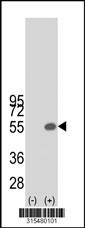 Western blot analysis of his-tag COG3 (arrow) using his tag antibody. 293 cell lysates (2 ug/lane) either nontransfected (Lane 2) or transiently transfected with theCOG3 gene