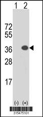Western blot analysis of his-tag CEP57 (arrow) using his tag antibody. 293 cell lysates (2 ug/lane) either nontransfected (Lane 2) or transiently transfected with theCEP57 gene