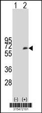 Western blot analysis of his-tag PNLIPRP2 (arrow) using his tag antibody. 293 cell lysates (2 ug/lane) either nontransfected (Lane 2) or transiently transfected with thePNLIPRP2 gene