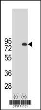 Western blot analysis of his-tag SILV (arrow) using his tag antibody. 293 cell lysates (2 ug/lane) either nontransfected (Lane 2) or transiently transfected with theSILV gene