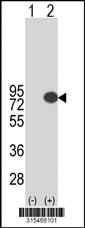 Western blot analysis of his-tag APPL1 (arrow) using his tag antibody. 293 cell lysates (2 ug/lane) either nontransfected (Lane 2) or transiently transfected with theAPPL1 gene
