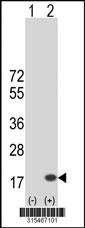 Western blot analysis of his-tag NICN1 (arrow) using his tag antibody. 293 cell lysates (2 ug/lane) either nontransfected (Lane 2) or transiently transfected with theNICN1 gene
