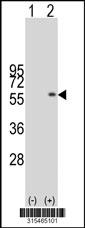 Western blot analysis of his-tag NET1 (arrow) using his tag antibody. 293 cell lysates (2 ug/lane) either nontransfected (Lane 2) or transiently transfected with theNET1 gene