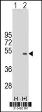 Western blot analysis of his-tag HSFY1 (arrow) using his tag antibody. 293 cell lysates (2 ug/lane) either nontransfected (Lane 2) or transiently transfected with theHSFY1 gene