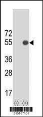 Western blot analysis of his-tag ERO1LB (arrow) using his tag antibody. 293 cell lysates (2 ug/lane) either nontransfected (Lane 2) or transiently transfected with theERO1LB gene