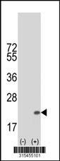 Western blot analysis of his-tag RFESD (arrow) using his tag antibody. 293 cell lysates (2 ug/lane) either nontransfected (Lane 2) or transiently transfected with theRFESD gene