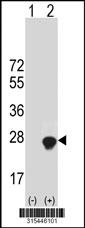 Western blot analysis of his-tag ANKRD39 (arrow) using his tag antibody. 293 cell lysates (2 ug/lane) either nontransfected (Lane 2) or transiently transfected with theANKRD39 gene