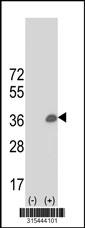 Western blot analysis of his-tag EHF (arrow) using his tag antibody. 293 cell lysates (2 ug/lane) either nontransfected (Lane 2) or transiently transfected with theEHF gene