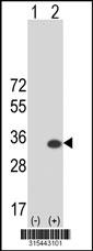 Western blot analysis of his-tag USP36 (arrow) using his tag antibody. 293 cell lysates (2 ug/lane) either nontransfected (Lane 2) or transiently transfected with theUSP36 gene