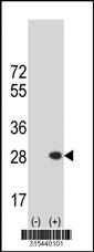 Western blot analysis of his-tag BBS5 (arrow) using his tag antibody. 293 cell lysates (2 ug/lane) either nontransfected (Lane 2) or transiently transfected with theBBS5 gene