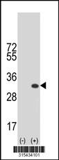 Western blot analysis of his-tag PRR16 (arrow) using his tag antibody. 293 cell lysates (2 ug/lane) either nontransfected (Lane 2) or transiently transfected with thePRR16 gene