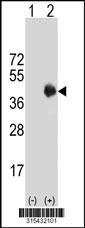 Western blot analysis of his-tag CLEC10A (arrow) using his tag antibody. 293 cell lysates (2 ug/lane) either nontransfected (Lane 2) or transiently transfected with theCLEC10A gene