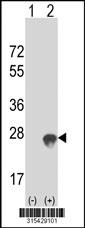 Western blot analysis of his-tag CHCHD4 (arrow) using his tag antibody. 293 cell lysates (2 ug/lane) either nontransfected (Lane 2) or transiently transfected with theCHCHD4 gene