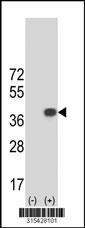 Western blot analysis of his-tag ZNF215 (arrow) using his tag antibody. 293 cell lysates (2 ug/lane) either nontransfected (Lane 2) or transiently transfected with theZNF215 gene