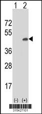 Western blot analysis of his-tag ZNF414 (arrow) using his tag antibody. 293 cell lysates (2 ug/lane) either nontransfected (Lane 2) or transiently transfected with theZNF414 gene