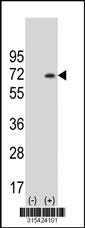 Western blot analysis of his-tag TRIM2 (arrow) using his tag antibody. 293 cell lysates (2 ug/lane) either nontransfected (Lane 2) or transiently transfected with theTRIM2 gene