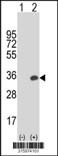 Western blot analysis of his-tag HSD17B6 (arrow) using his tag antibody. 293T cell lysates (2 ug/lane) either nontransfected (Lane 1) or transiently transfected with the HSD17B6 gene‘