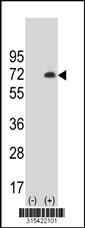 Western blot analysis of his-tag WDTC1 (arrow) using his tag antibody. 293 cell lysates (2 ug/lane) either nontransfected (Lane 2) or transiently transfected with theWDTC1 gene