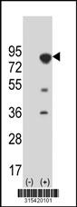 Western blot analysis of his-tag LILRB1 (arrow) using his tag antibody. 293 cell lysates (2 ug/lane) either nontransfected (Lane 2) or transiently transfected with theLILRB1 gene