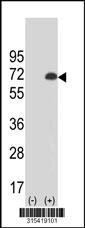 Western blot analysis of his-tag MSLN (arrow) using his tag antibody. 293 cell lysates (2 ug/lane) either nontransfected (Lane 2) or transiently transfected with theMSLN gene