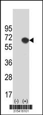 Western blot analysis of his-tag TRIP4 (arrow) using his tag antibody. 293 cell lysates (2 ug/lane) either nontransfected (Lane 2) or transiently transfected with theTRIP4 gene