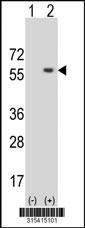 Western blot analysis of his-tag CPNE6 (arrow) using his tag antibody. 293 cell lysates (2 ug/lane) either nontransfected (Lane 2) or transiently transfected with theCPNE6 gene