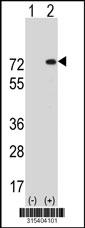Western blot analysis of his-tag MLPH (arrow) using his tag antibody. 293 cell lysates (2 ug/lane) either nontransfected (Lane 2) or transiently transfected with theMLPH gene