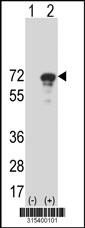 Western blot analysis of his-tag SH3BP1 (arrow) using his tag antibody. 293 cell lysates (2 ug/lane) either nontransfected (Lane 2) or transiently transfected with theSH3BP1 gene