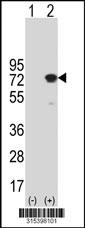 Western blot analysis of his-tag PPP2R5D (arrow) using his tag antibody. 293 cell lysates (2 ug/lane) either nontransfected (Lane 2) or transiently transfected with thePPP2R5D gene