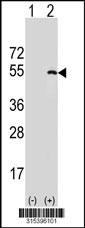 Western blot analysis of his-tag KPTN (arrow) using his tag antibody. 293 cell lysates (2 ug/lane) either nontransfected (Lane 2) or transiently transfected with theKPTN gene