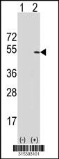 Western blot analysis of his-tag KRT23 (arrow) using his tag antibody. 293 cell lysates (2 ug/lane) either nontransfected (Lane 2) or transiently transfected with theKRT23 gene