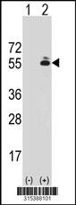 Western blot analysis of his-tag TUBB6 (arrow) using his tag antibody. 293 cell lysates (2 ug/lane) either nontransfected (Lane 2) or transiently transfected with theTUBB6 gene