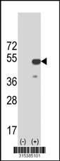 Western blot analysis of his-tag TXNDC4 (arrow) using his tag antibody. 293 cell lysates (2 ug/lane) either nontransfected (Lane 2) or transiently transfected with theTXNDC4 gene