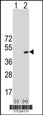 Western blot analysis of his-tag GNA14 (arrow) using his tag antibody. 293 cell lysates (2 ug/lane) either nontransfected (Lane 2) or transiently transfected with theGNA14 gene