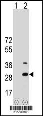 Western blot analysis of his-tag UQCRFS1 (arrow) using his tag antibody. 293 cell lysates (2 ug/lane) either nontransfected (Lane 2) or transiently transfected with theUQCRFS1 gene