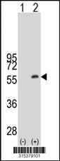 Western blot analysis of his-tag TRIM44 (arrow) using his tag antibody. 293 cell lysates (2 ug/lane) either nontransfected (Lane 2) or transiently transfected with theTRIM44 gene