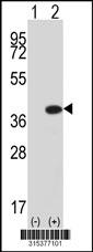 Western blot analysis of his-tag C5orf25 (arrow) using his tag antibody. 293 cell lysates (2 ug/lane) either nontransfected (Lane 2) or transiently transfected with theC5orf25 gene