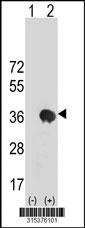 Western blot analysis of his-tag FAM76A (arrow) using his tag antibody. 293 cell lysates (2 ug/lane) either nontransfected (Lane 2) or transiently transfected with theFAM76A gene