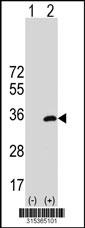 Western blot analysis of his-tag VTI1B (arrow) using his tag antibody. 293 cell lysates (2 ug/lane) either nontransfected (Lane 2) or transiently transfected with theVTI1B gene