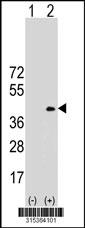 Western blot analysis of his-tag RNASET2 (arrow) using his tag antibody. 293 cell lysates (2 ug/lane) either nontransfected (Lane 2) or transiently transfected with theRNASET2 gene