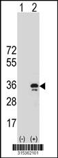 Western blot analysis of his-tag REEP4 (arrow) using his tag antibody. 293 cell lysates (2 ug/lane) either nontransfected (Lane 2) or transiently transfected with theREEP4 gene