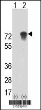 Western blot analysis of his-tag CCDC9 (arrow) using his tag antibody. 293 cell lysates (2 ug/lane) either nontransfected (Lane 2) or transiently transfected with theCCDC9 gene