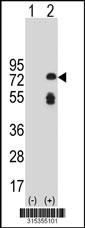Western blot analysis of his-tag RPH3A (arrow) using his tag antibody. 293 cell lysates (2 ug/lane) either nontransfected (Lane 2) or transiently transfected with theRPH3A gene